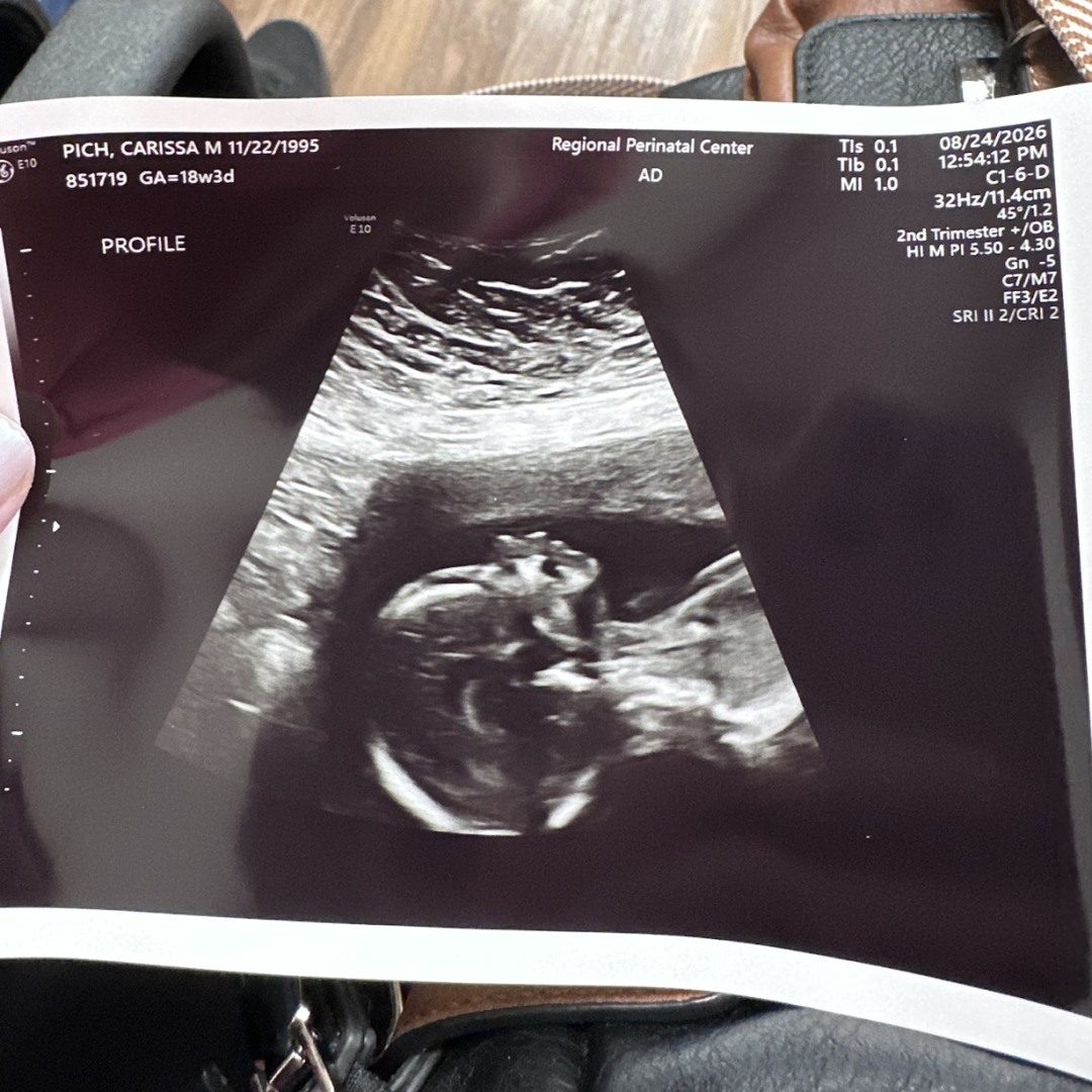 Photo shared by Carissa for their Babylist baby registry.
