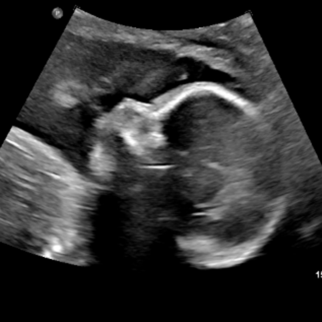 Photo shared by Abby for their Babylist baby registry.