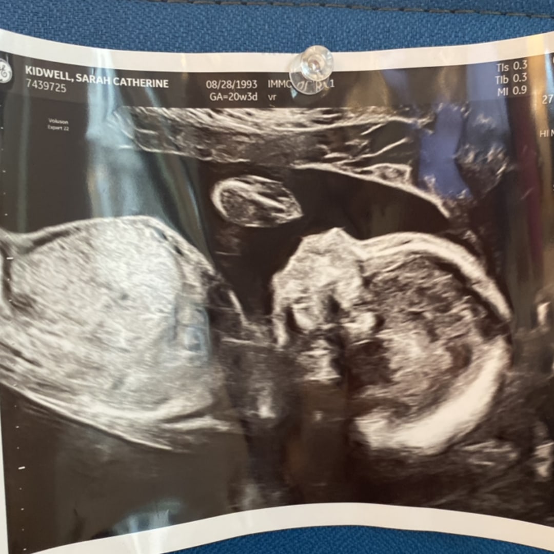 Photo shared by Sarah for their Babylist baby registry.