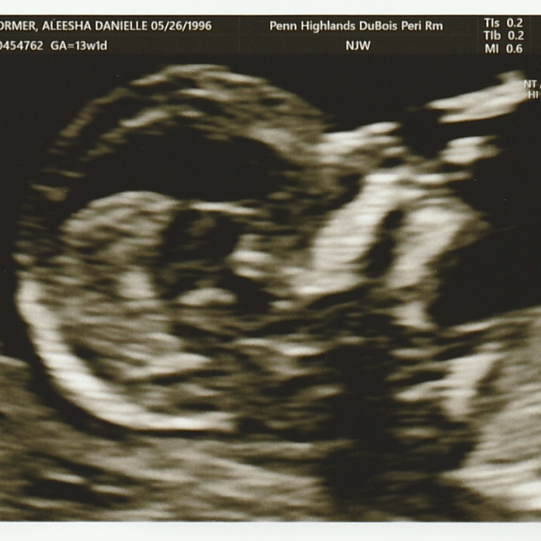 Photo shared by Aleesha for their Babylist baby registry.