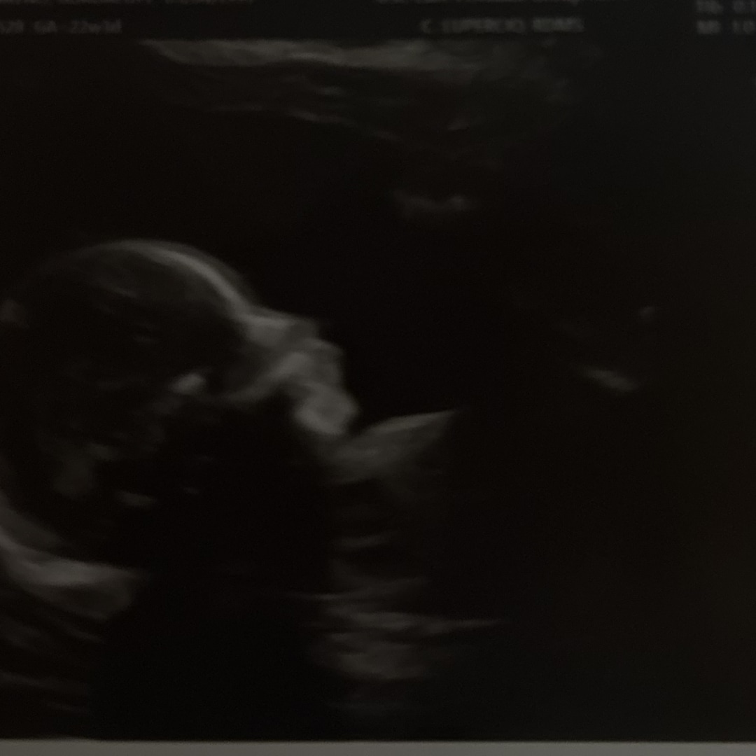 Photo shared by Guadalupe for their Babylist baby registry.