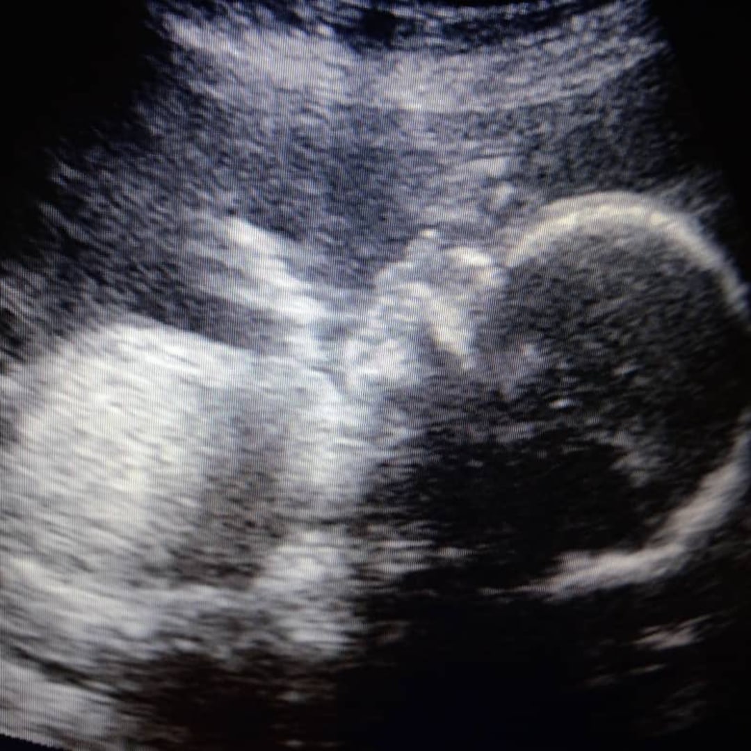 Photo shared by Lisandra for their Babylist baby registry.