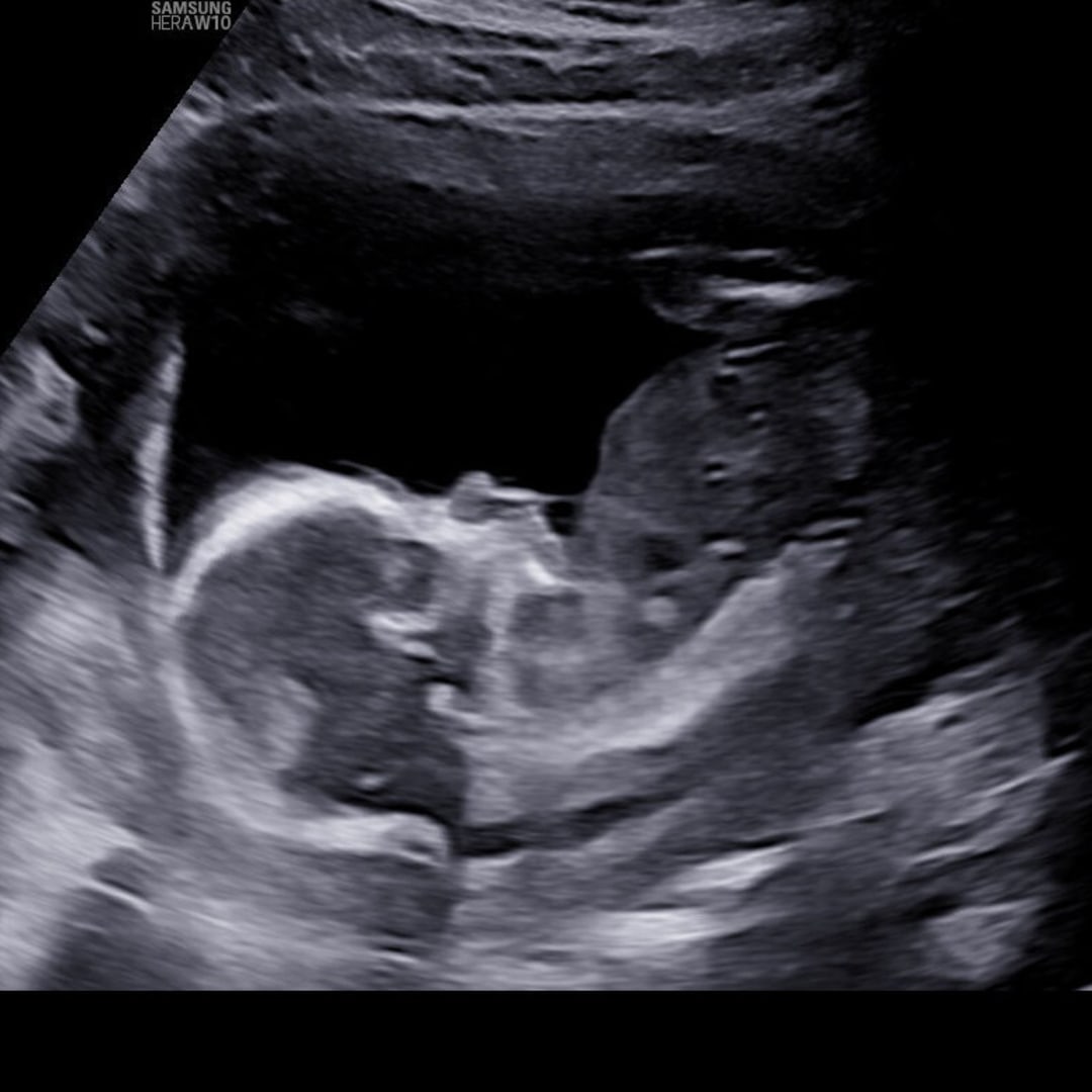 Photo shared by Charmaine for their Babylist baby registry.