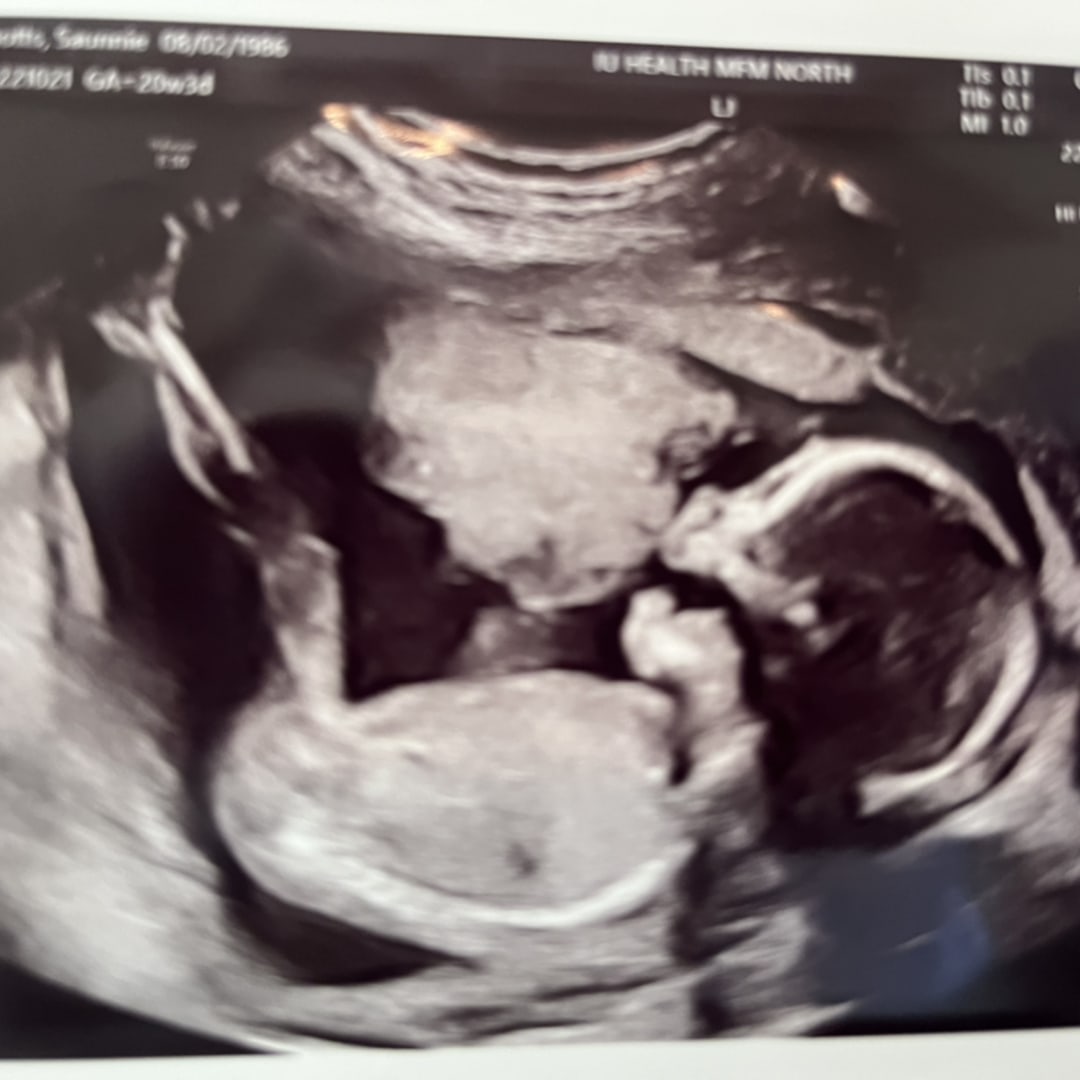 Photo shared by Saunnie for their Babylist baby registry.