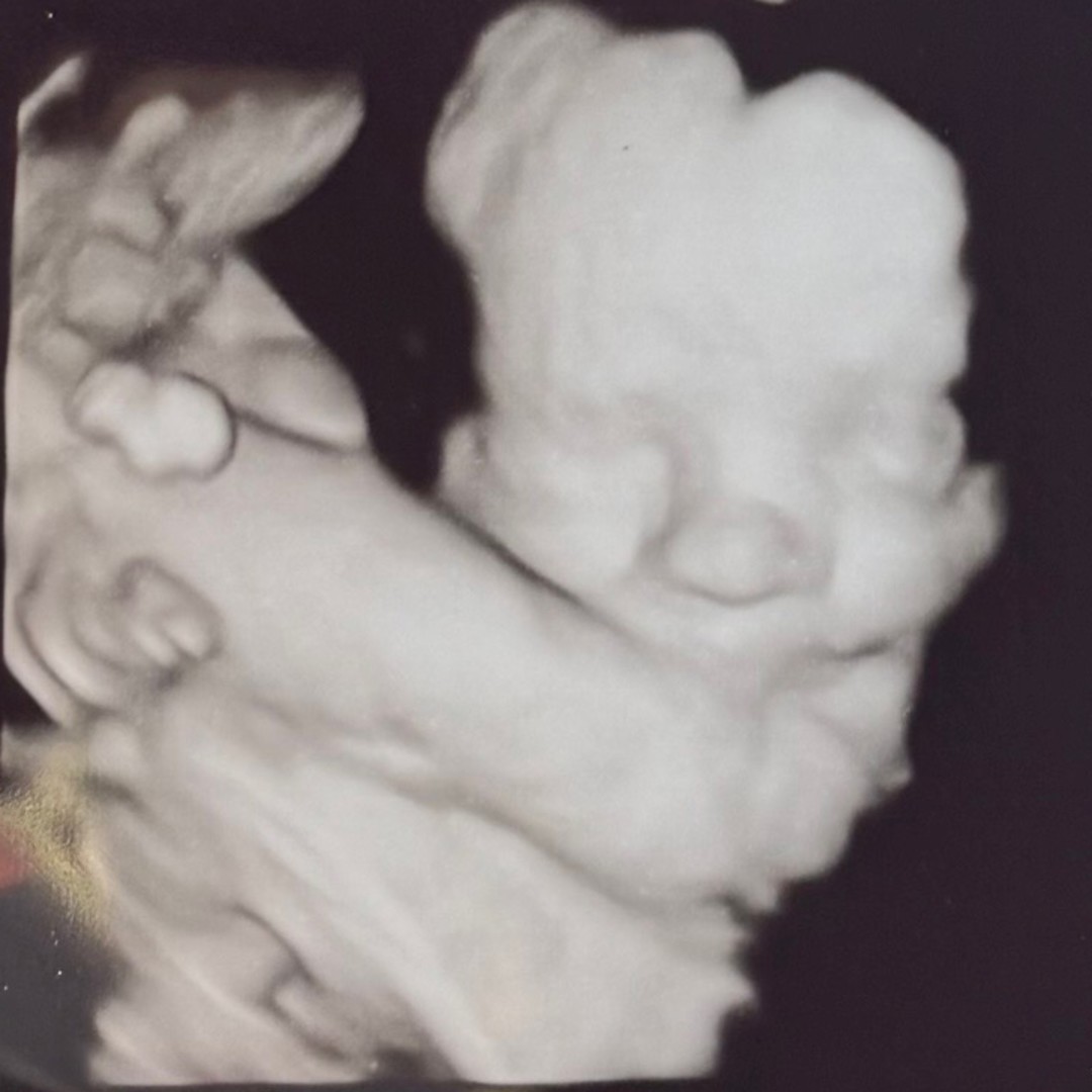 Photo shared by Nikki for their Babylist baby registry.