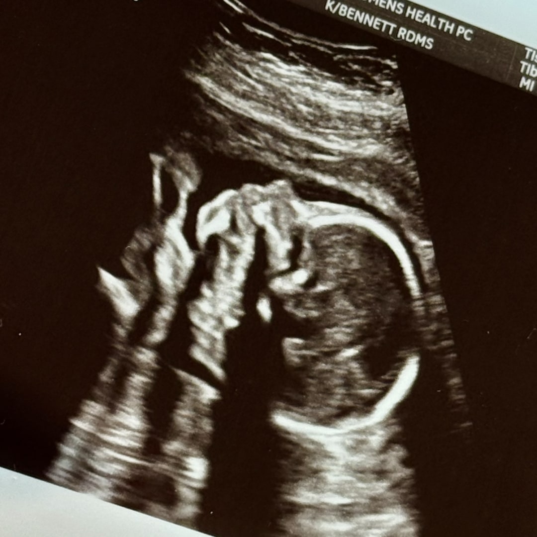 Photo shared by Laura for their Babylist baby registry.