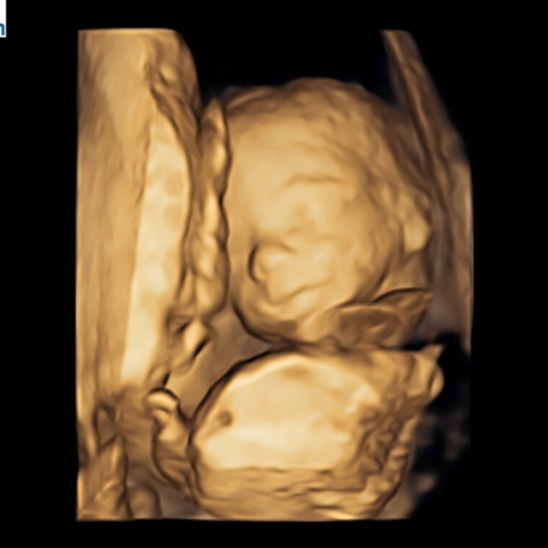 Photo shared by Emily for their Babylist baby registry.