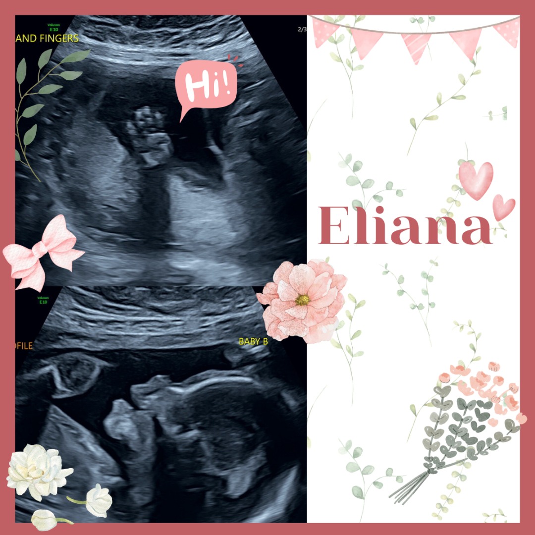 Photo shared by Shantel for their Babylist baby registry.