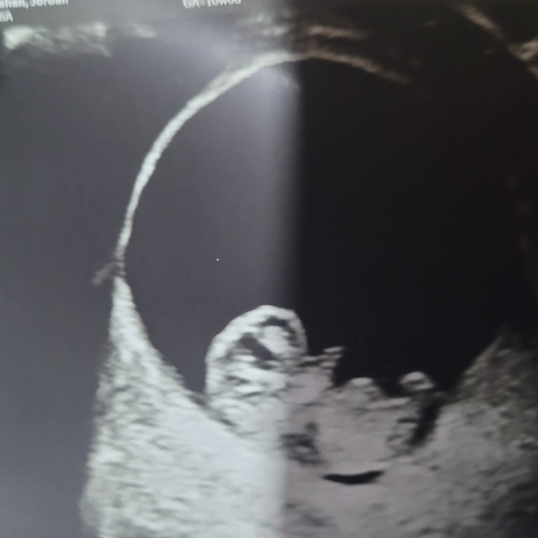 Photo shared by Brayden for their Babylist baby registry.