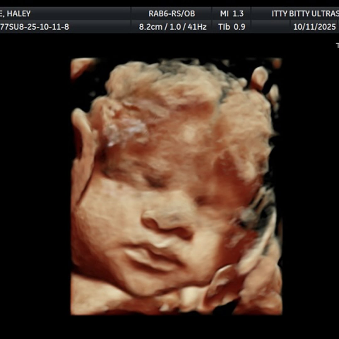 Photo shared by Haley for their Babylist baby registry.