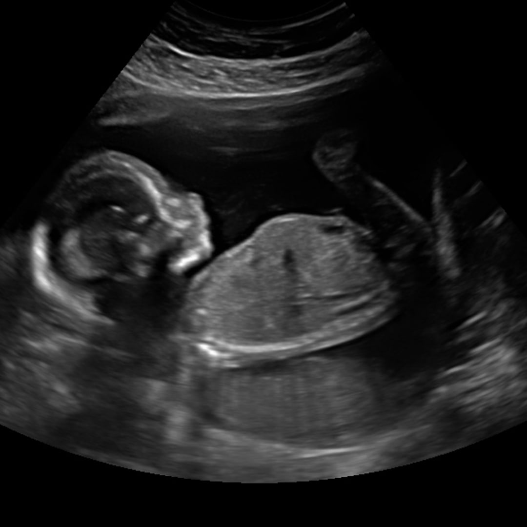 Photo shared by Dayna for their Babylist baby registry.