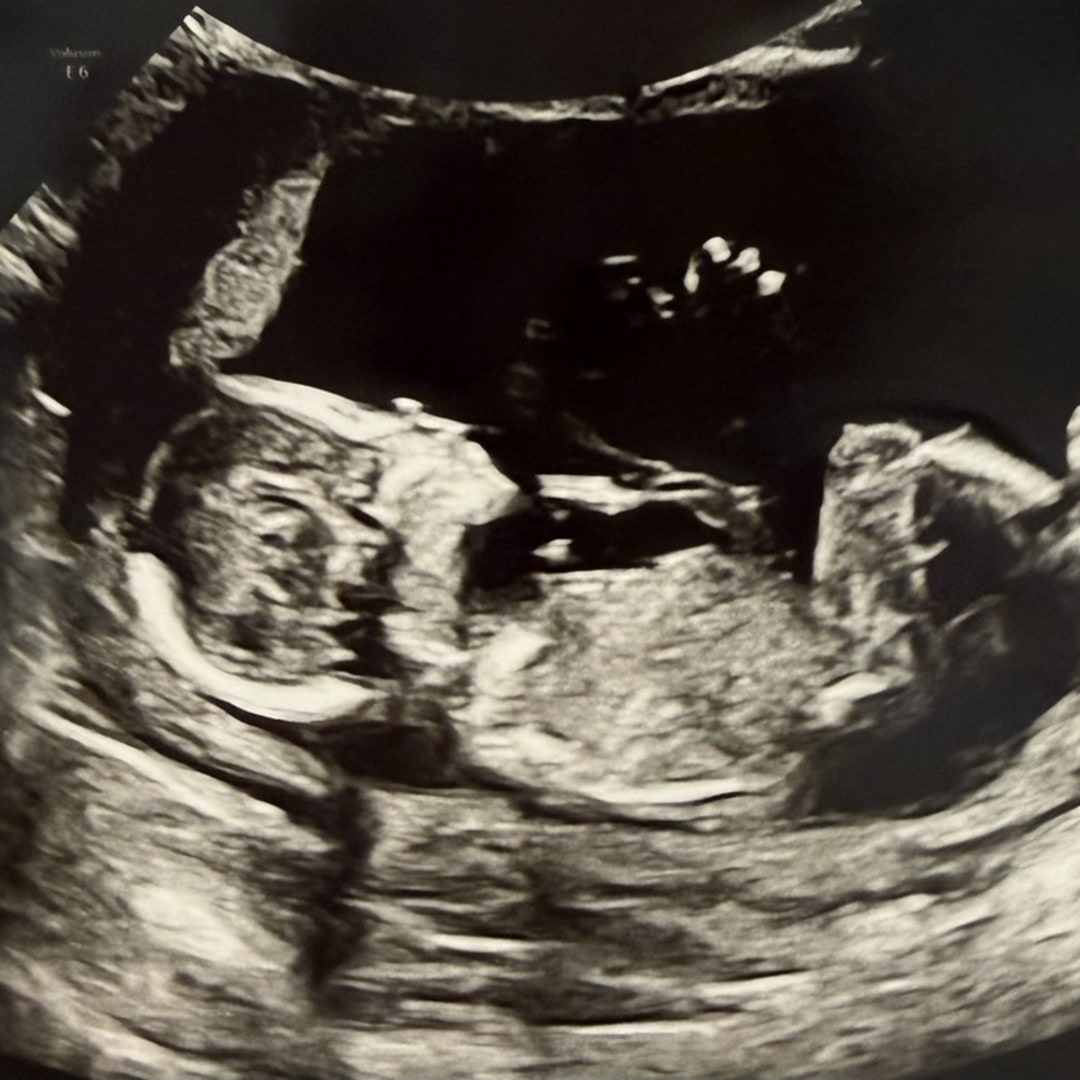 Photo shared by Darrion for their Babylist baby registry.