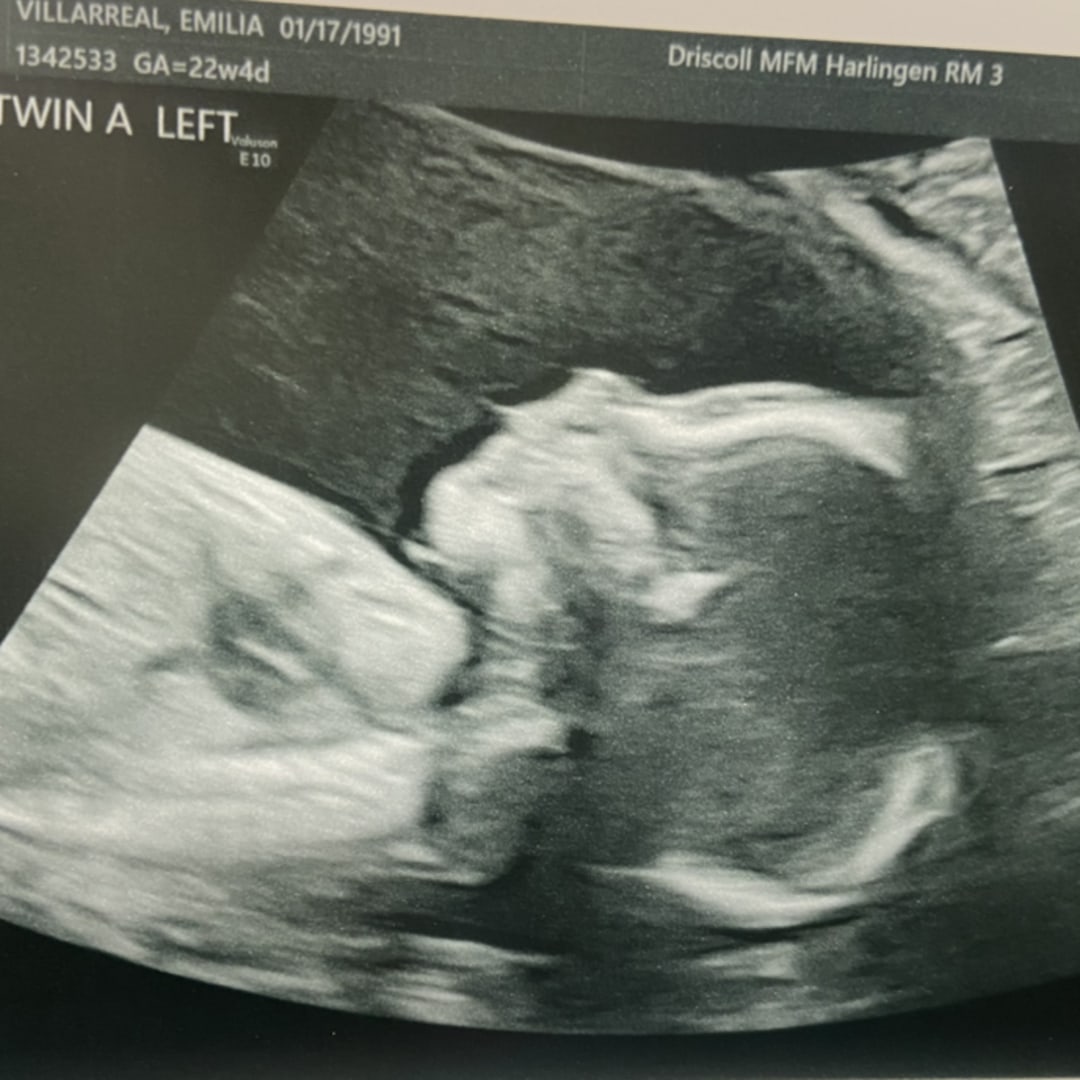 Photo shared by Emily for their Babylist baby registry.