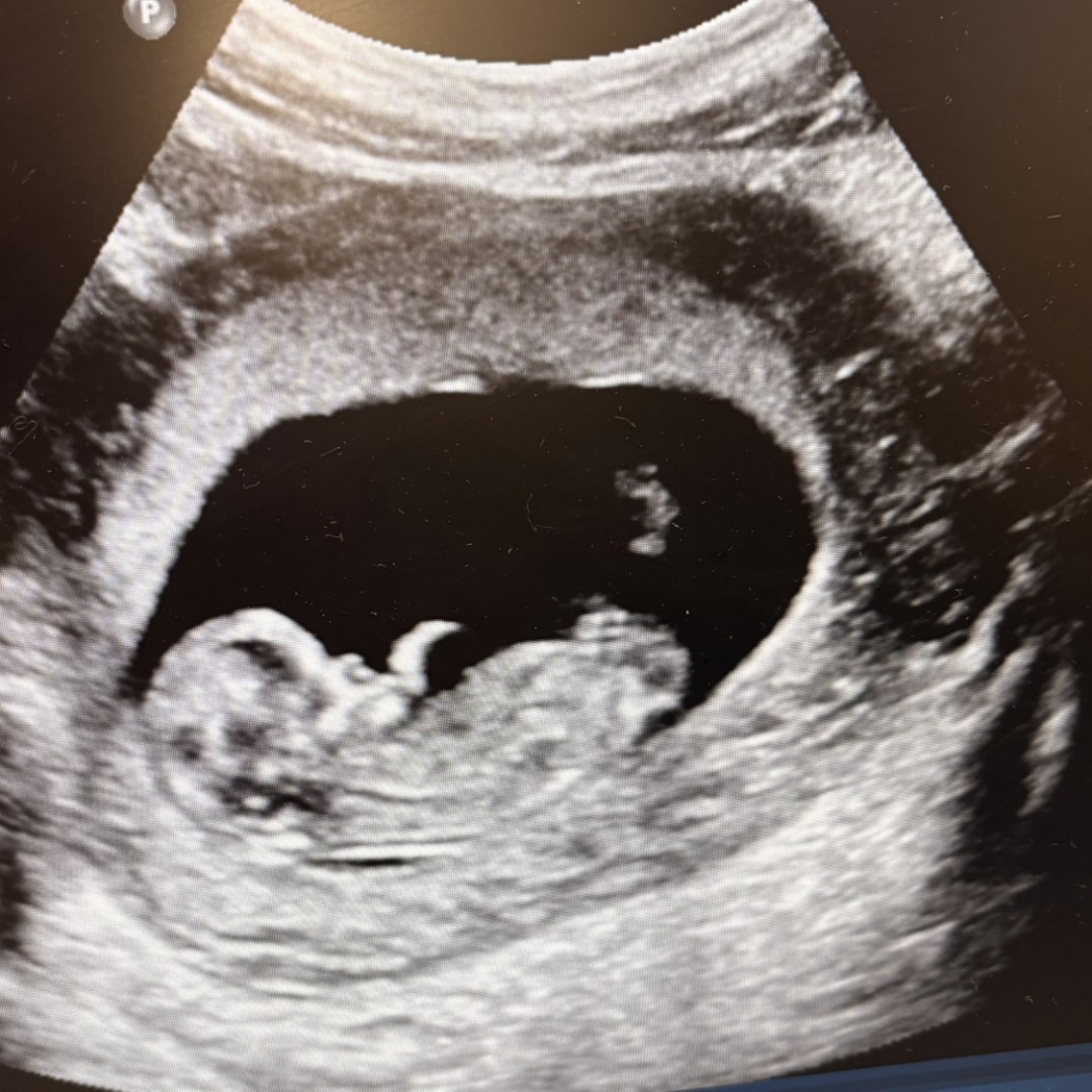 Photo shared by Niecy for their Babylist baby registry.