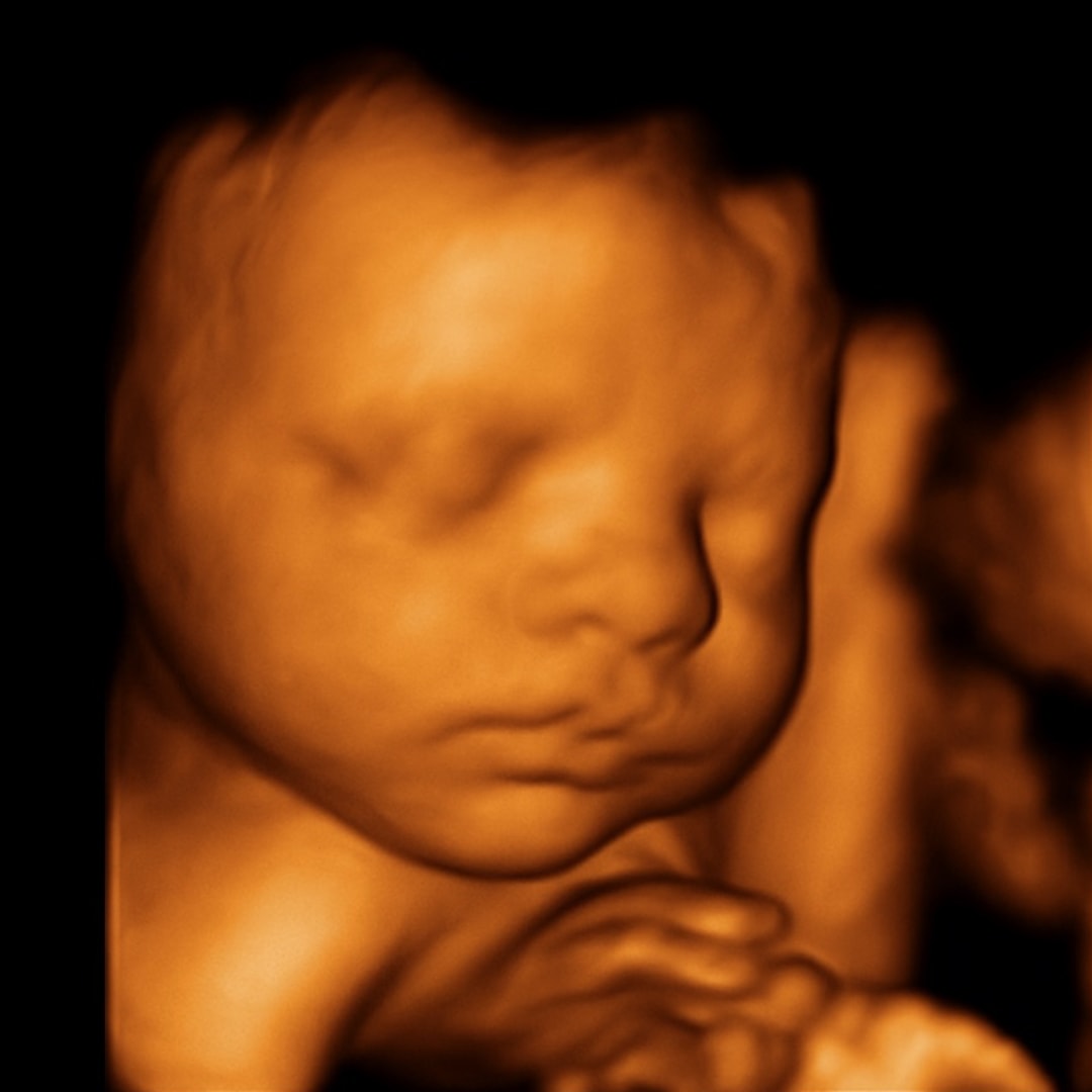 Photo shared by Hannah for their Babylist baby registry.