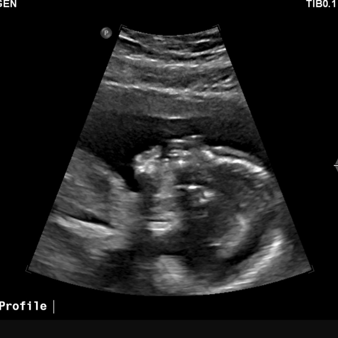 Photo shared by Erica for their Babylist baby registry.