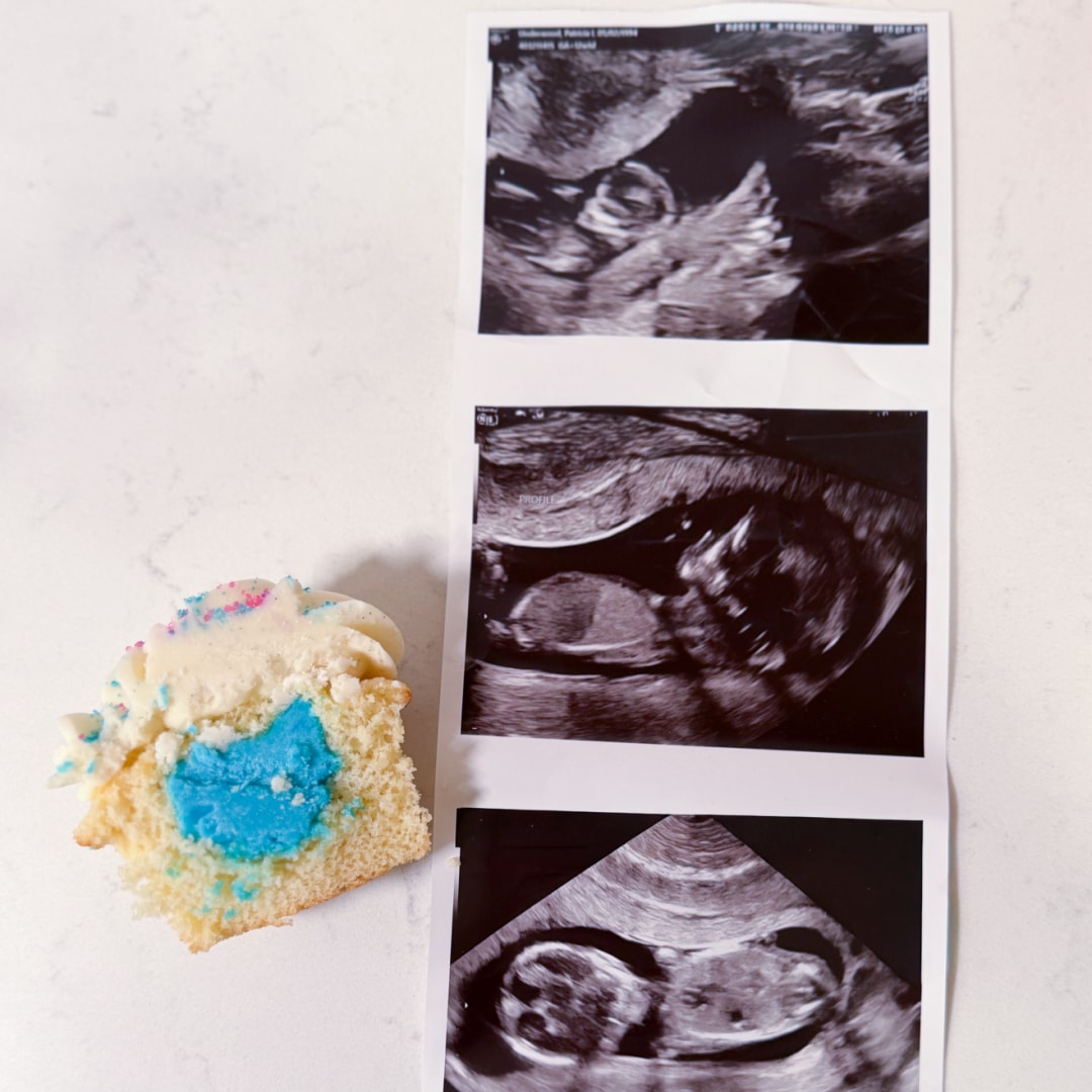 Photo shared by Patricia for their Babylist baby registry.
