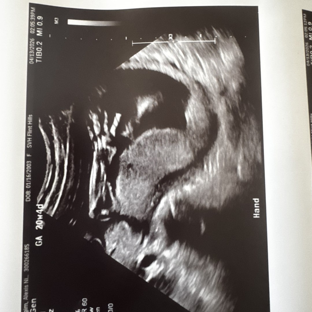 Photo shared by Alexis for their Babylist baby registry.