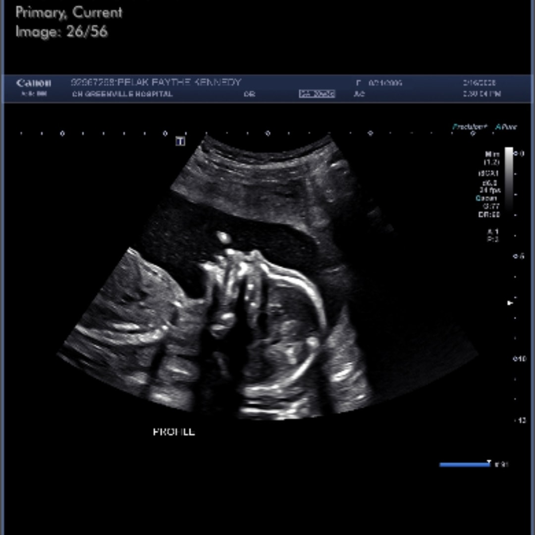 Photo shared by Faythe for their Babylist baby registry.