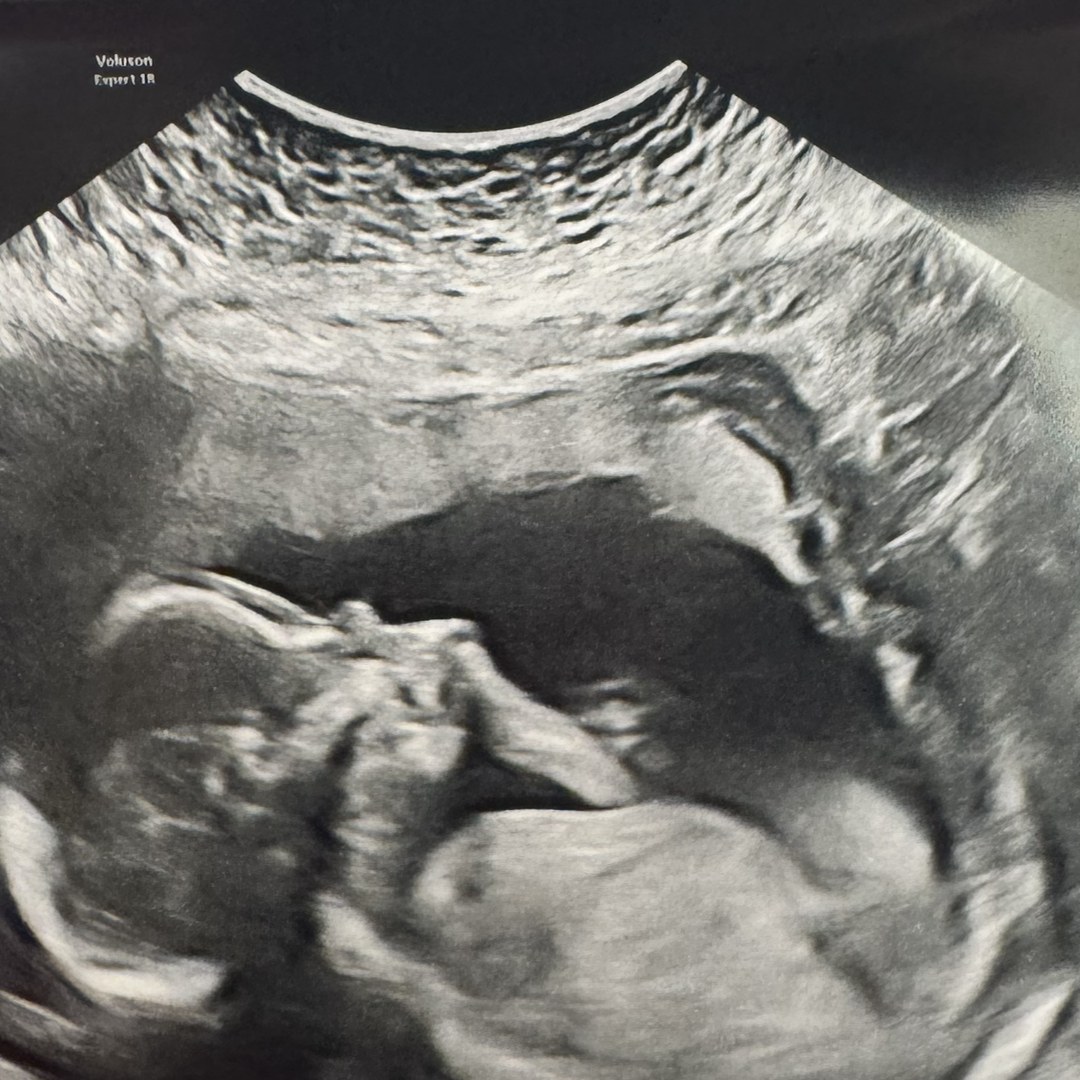 Photo shared by Lauren for their Babylist baby registry.