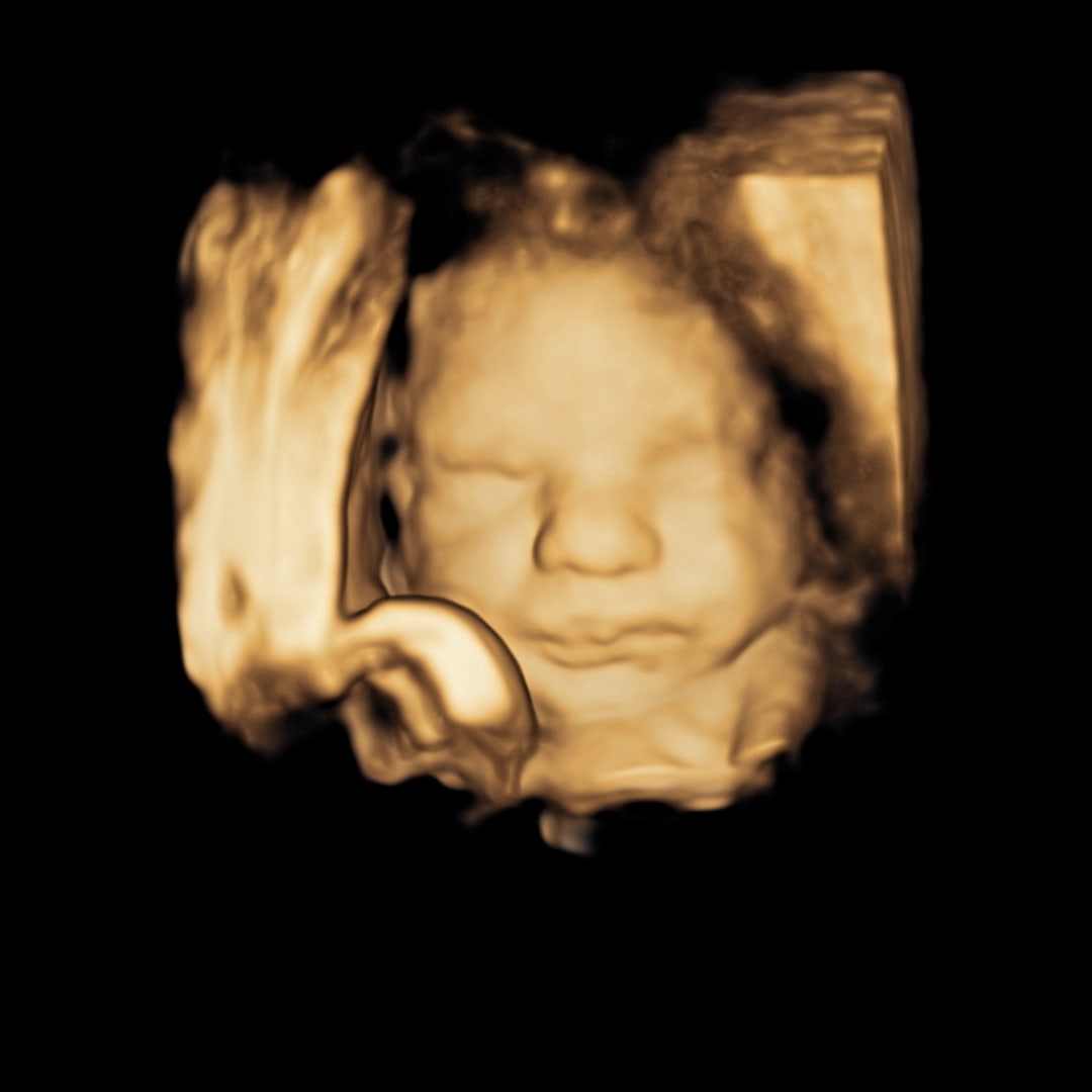 Photo shared by Abby for their Babylist baby registry.