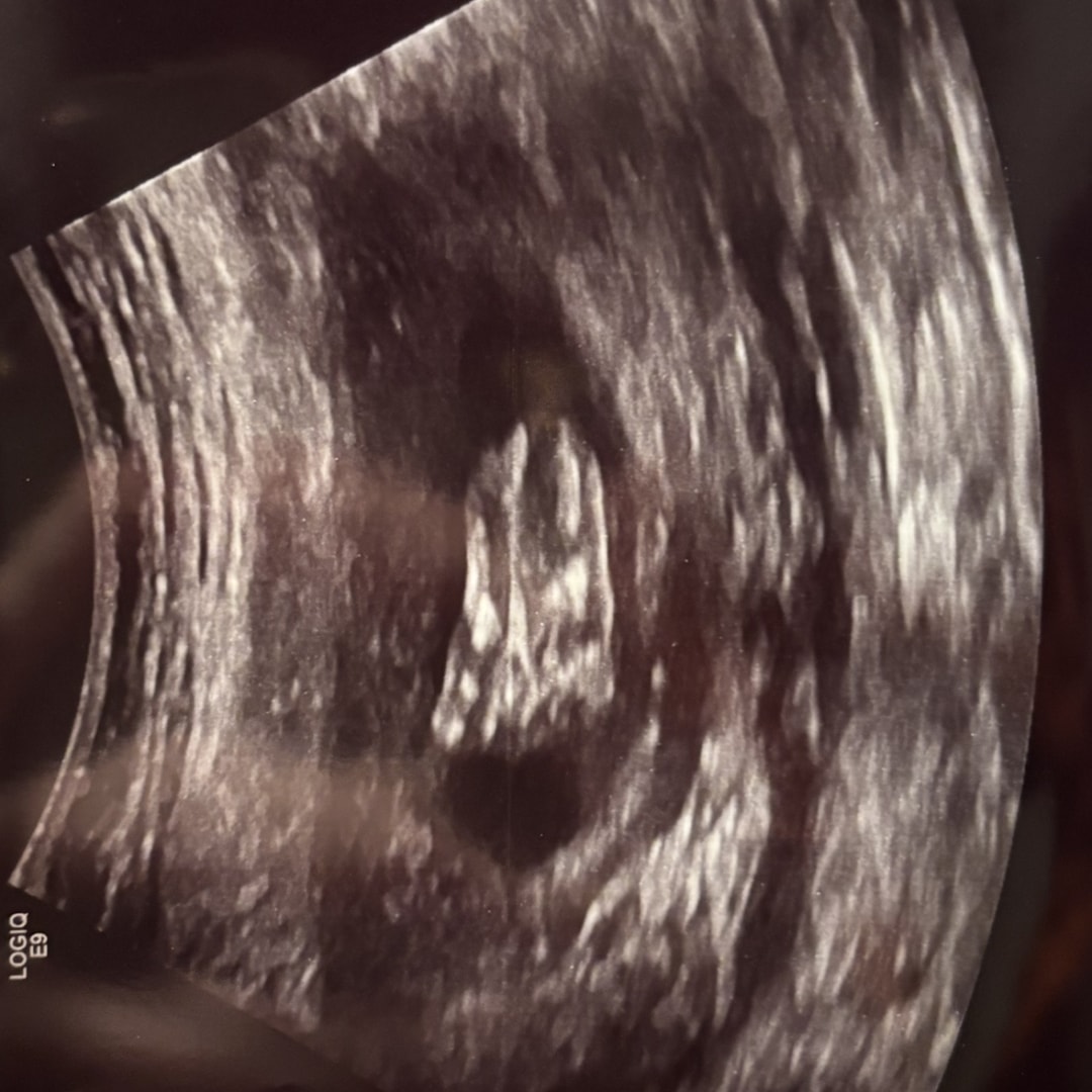 Photo shared by Emma for their Babylist baby registry.