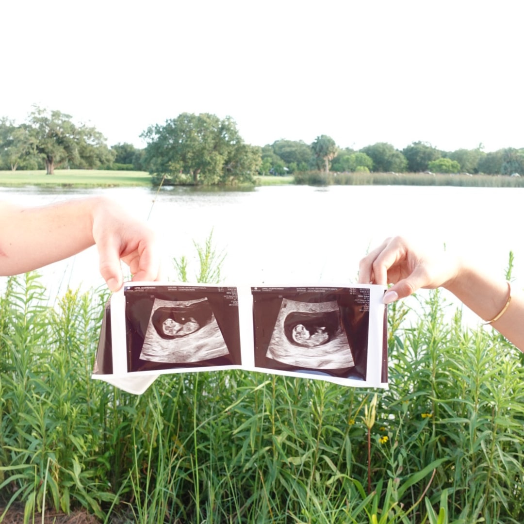 Photo shared by Juliette for their Babylist baby registry.