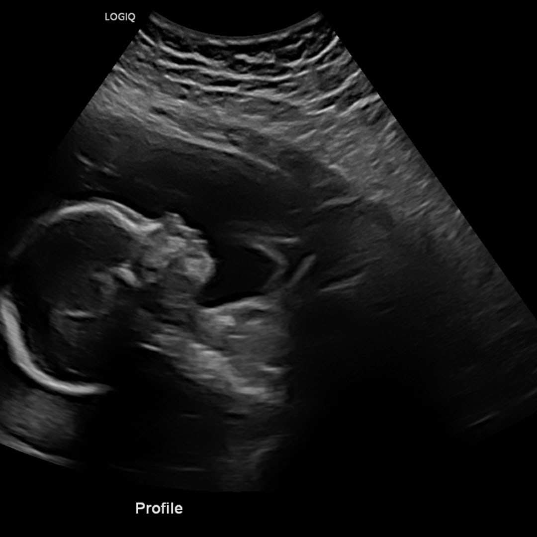 Photo shared by Abigail for their Babylist baby registry.