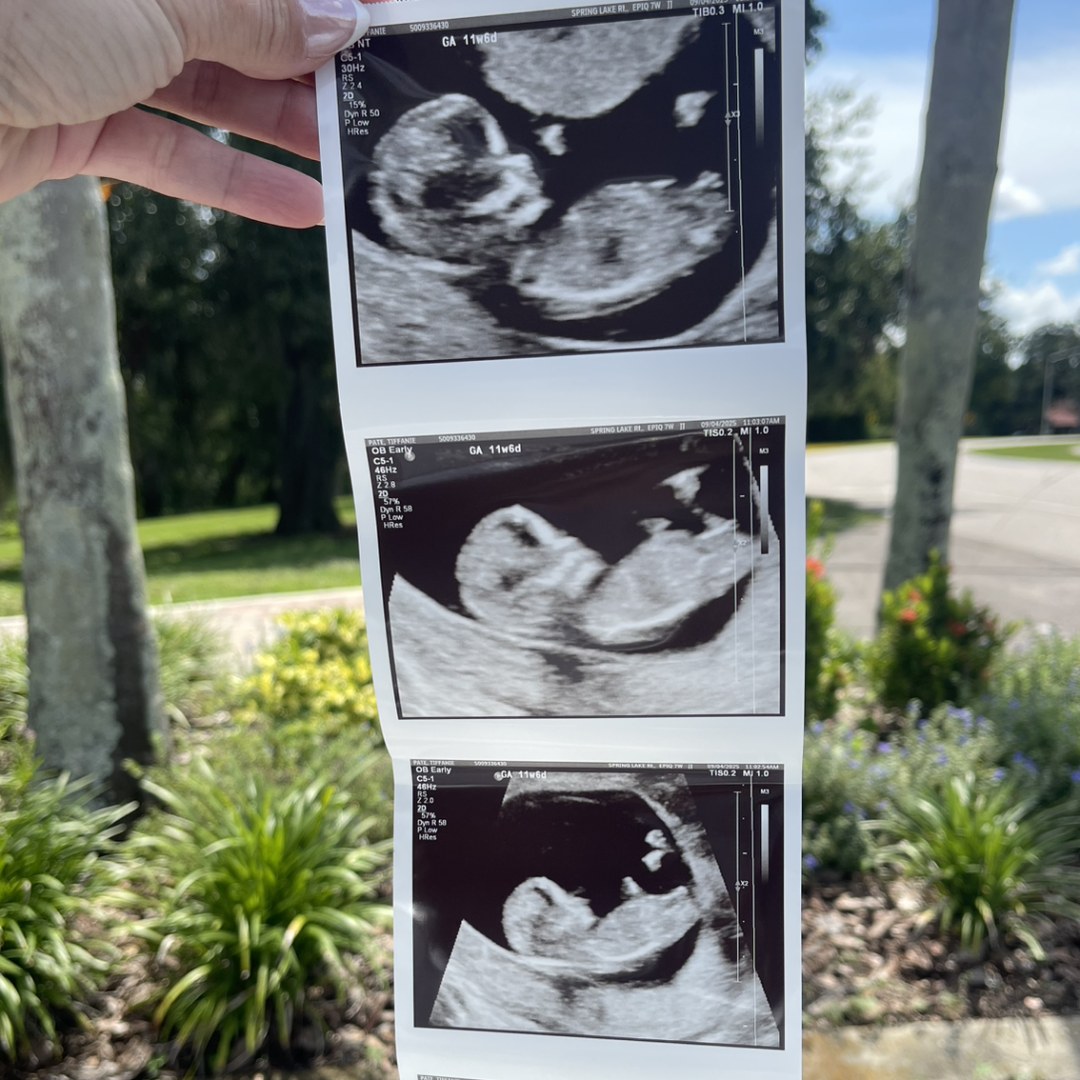 Photo shared by Tiffanie for their Babylist baby registry.