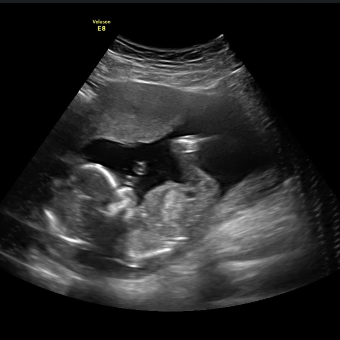 Photo shared by Emily for their Babylist baby registry.