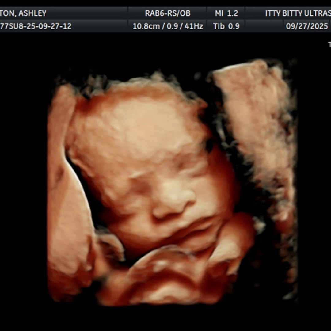 Photo shared by Ashley for their Babylist baby registry.