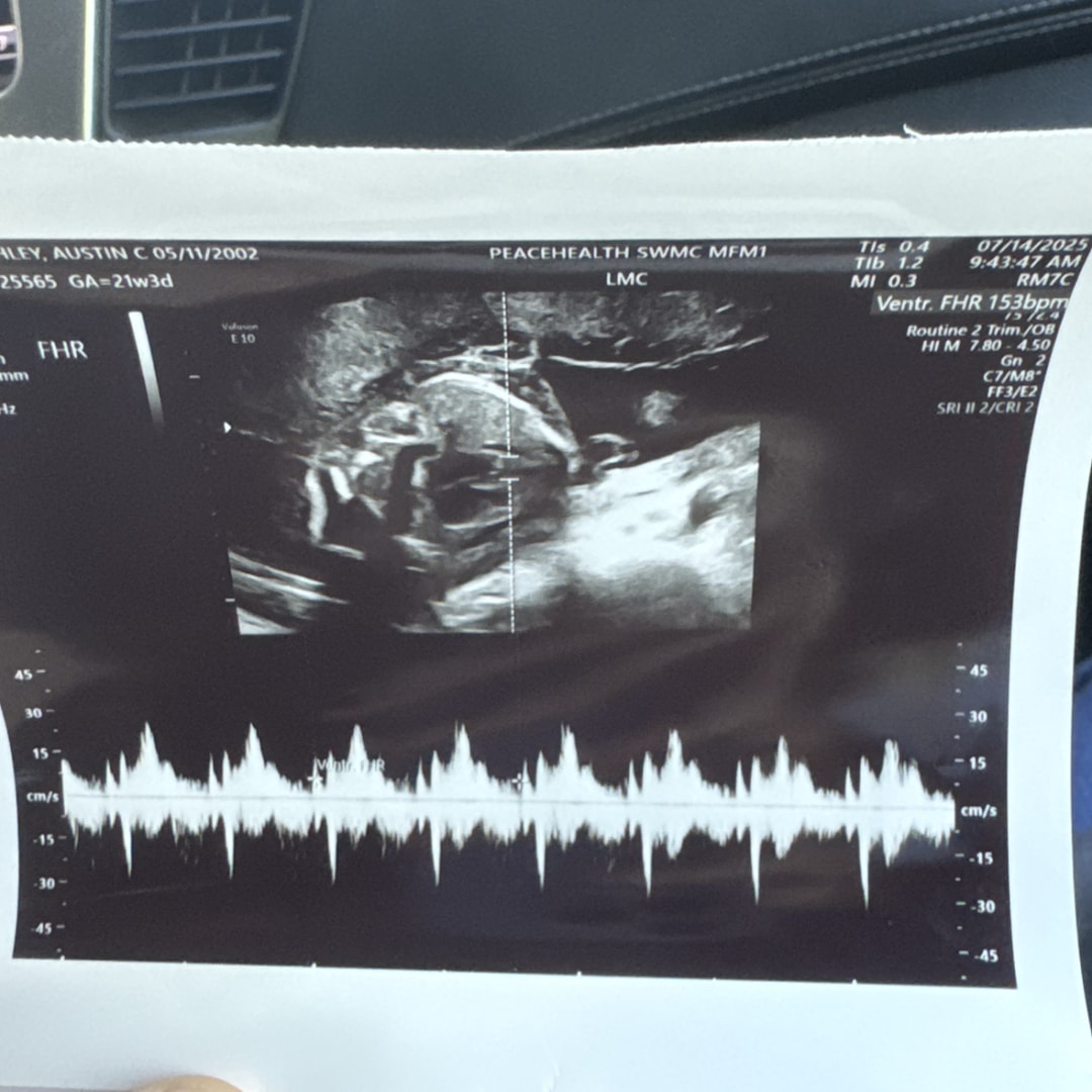 Photo shared by Austin for their Babylist baby registry.