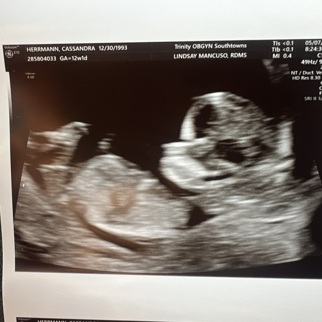 Photo shared by Cassie for their Babylist baby registry.