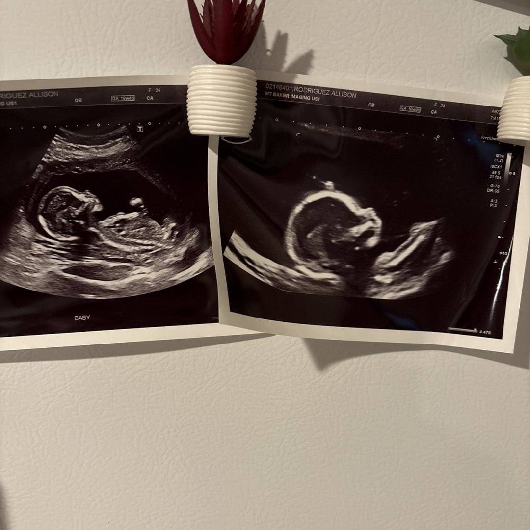 Photo shared by Gracie for their Babylist baby registry.