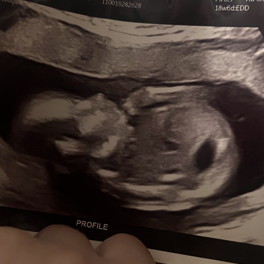 Photo shared by Isabel for their Babylist baby registry.