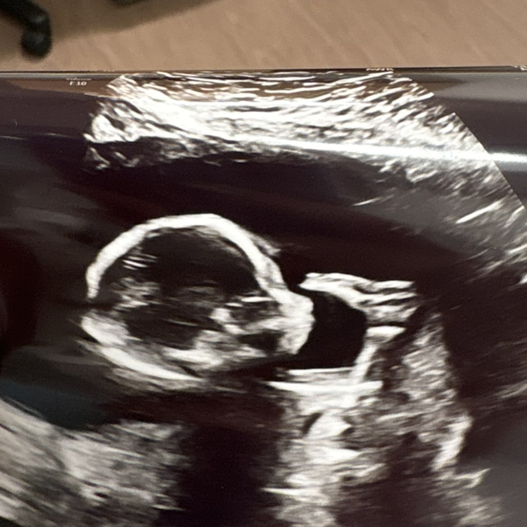 Photo shared by Cara Beth for their Babylist baby registry.