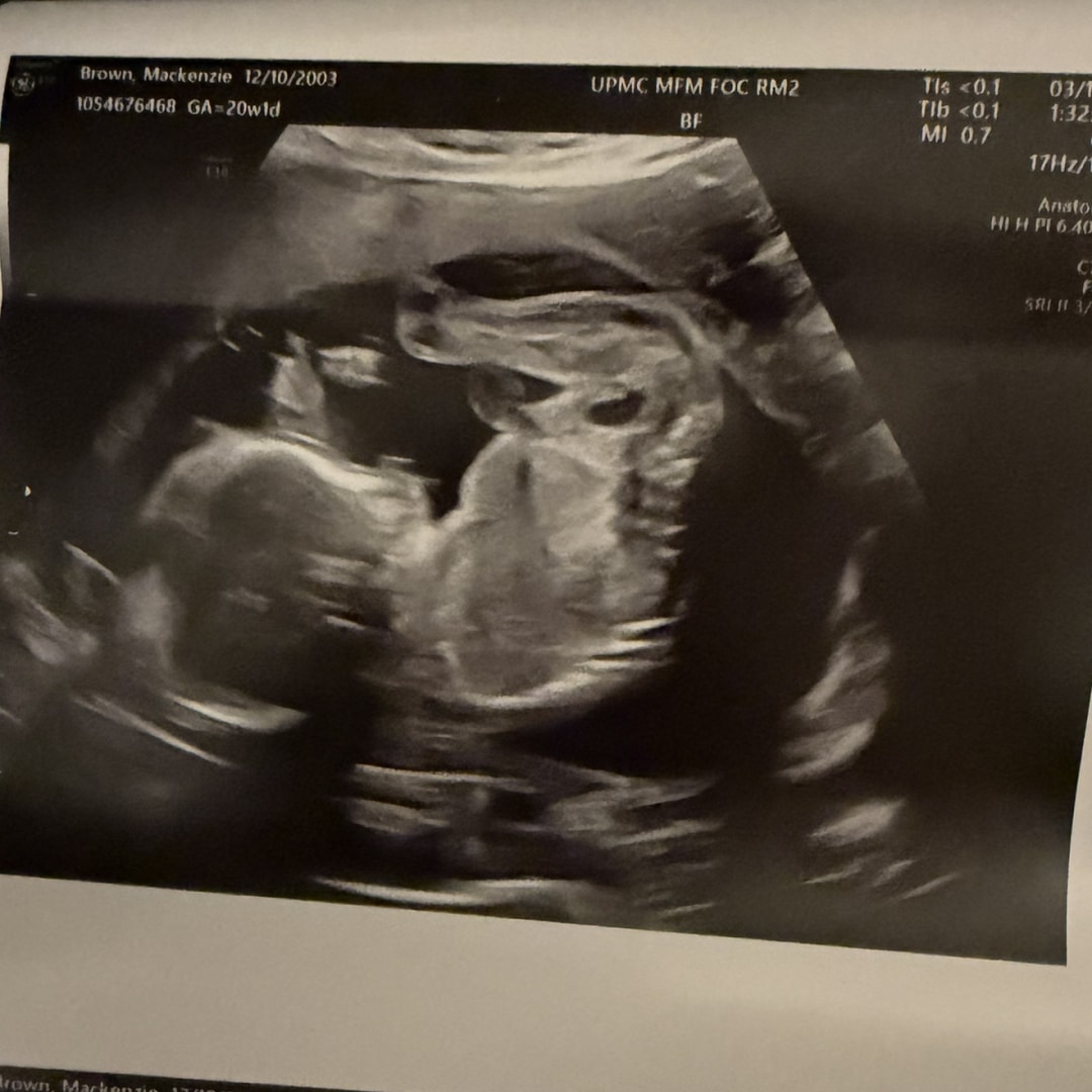 Photo shared by Mackenzie for their Babylist baby registry.