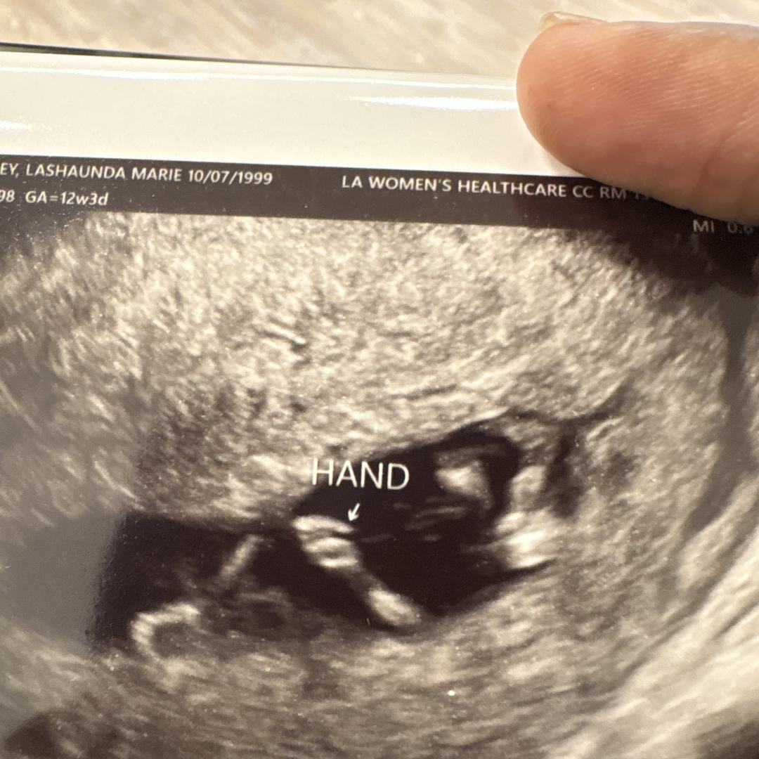 Photo shared by Lashaunda for their Babylist baby registry.