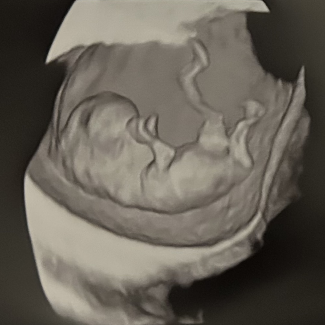 Photo shared by Promise for their Babylist baby registry.