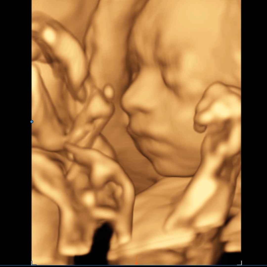 Photo shared by Riley for their Babylist baby registry.