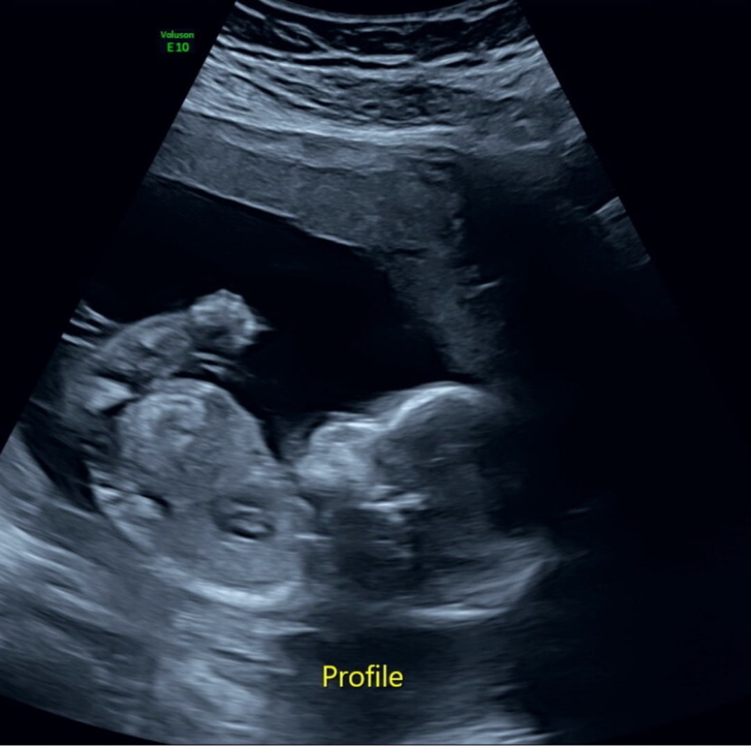 Photo shared by Aubrey for their Babylist baby registry.
