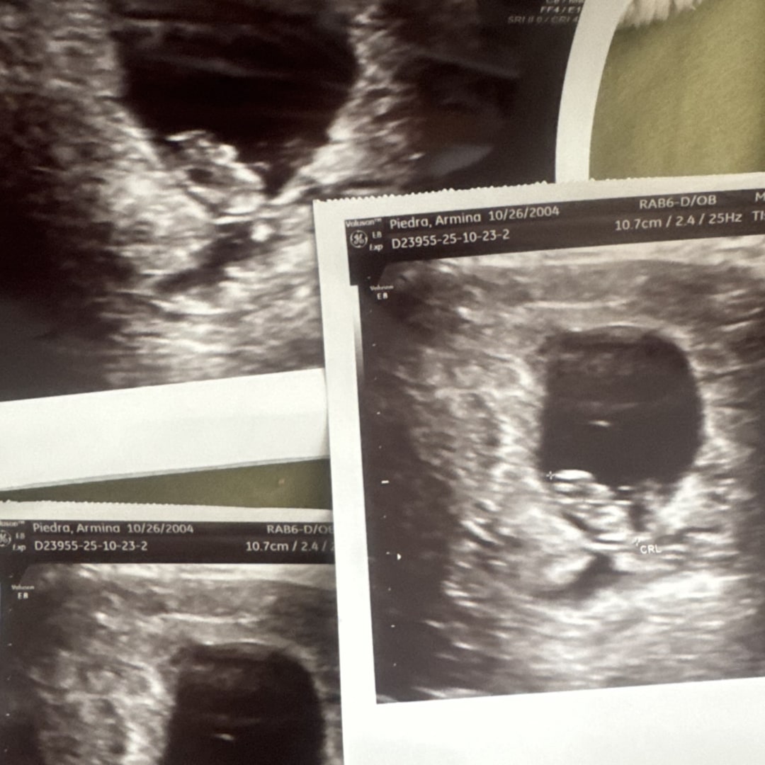 Photo shared by Armina for their Babylist baby registry.