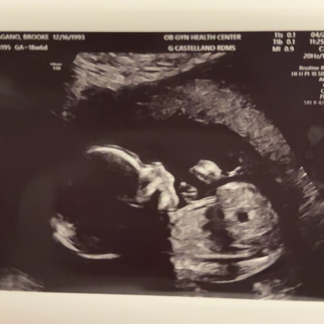 Photo shared by Brooke for their Babylist baby registry.