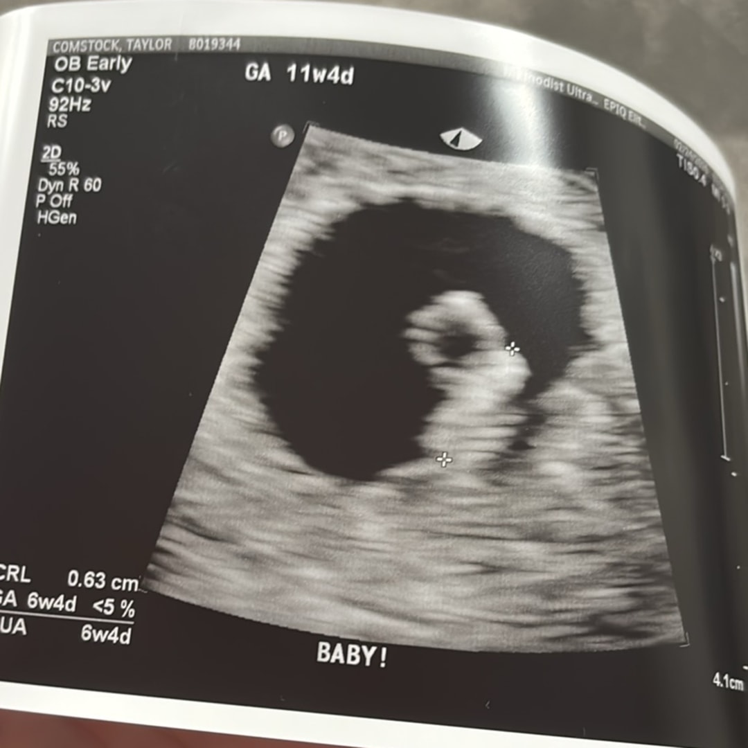 Photo shared by Taylor for their Babylist baby registry.