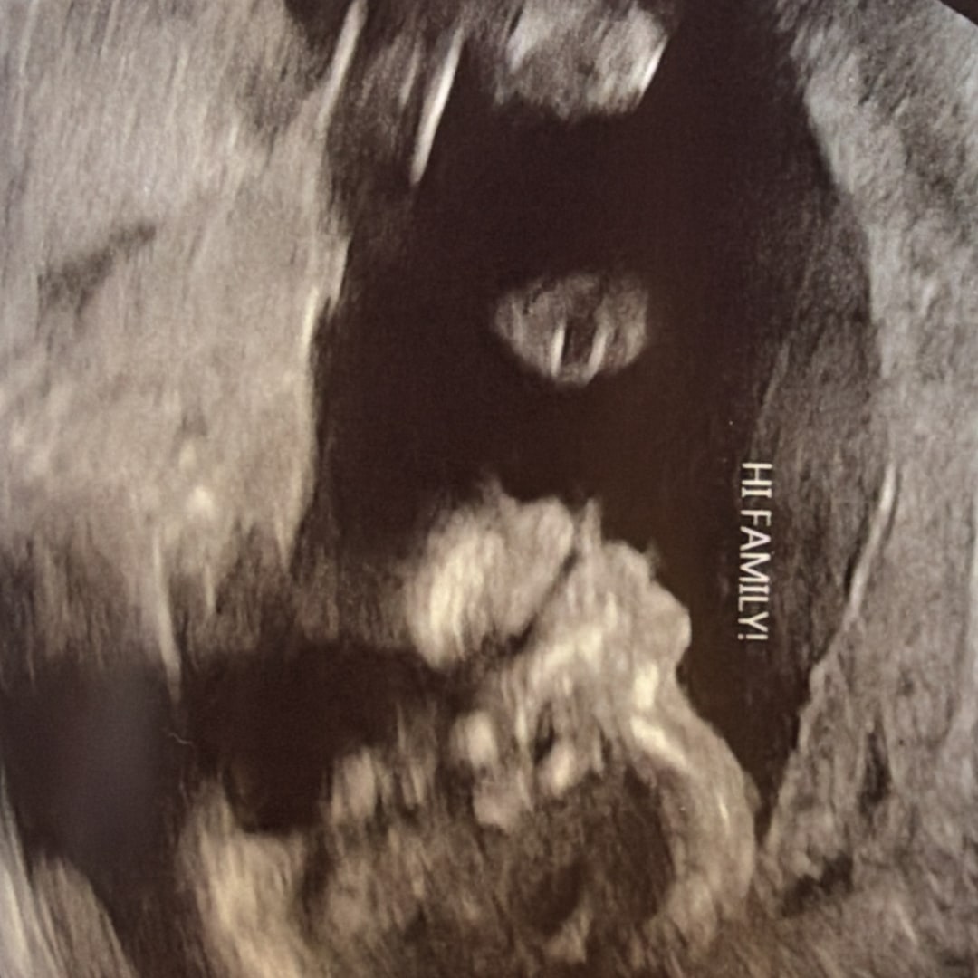 Photo shared by Adamaris for their Babylist baby registry.