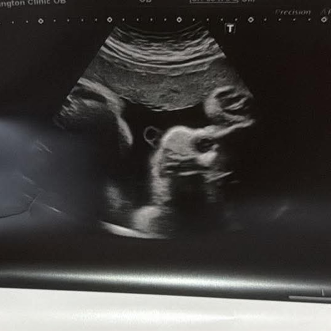 Photo shared by Makenzie for their Babylist baby registry.