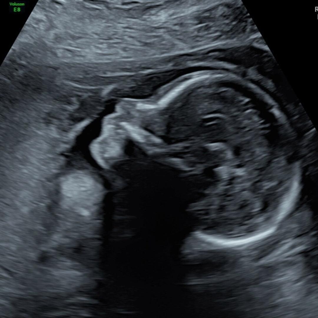 Photo shared by Shailee And Ricky for their Babylist baby registry.