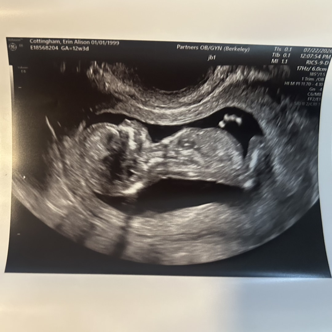 Photo shared by Erin for their Babylist baby registry.