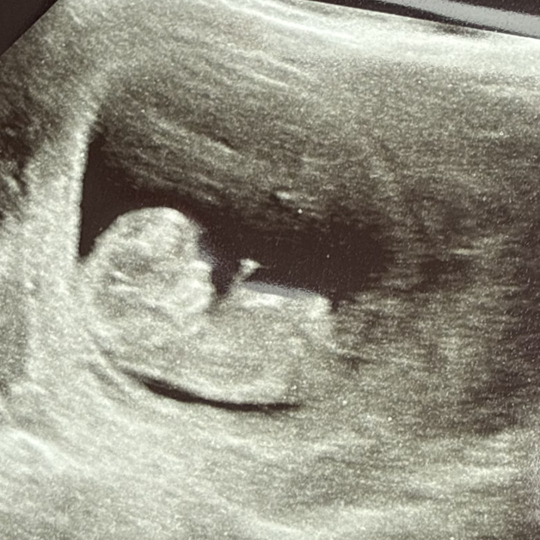Photo shared by Victoria for their Babylist baby registry.