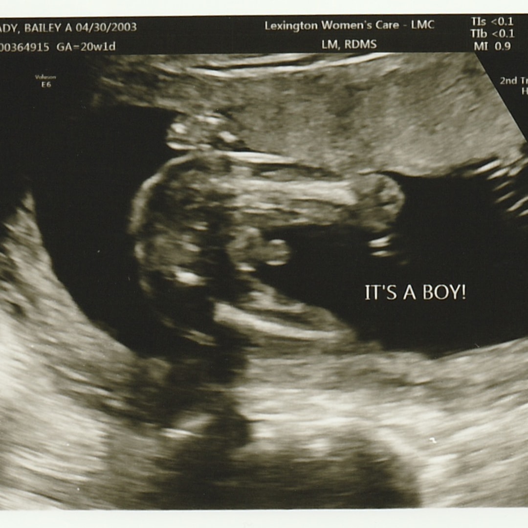 Photo shared by Bailey for their Babylist baby registry.